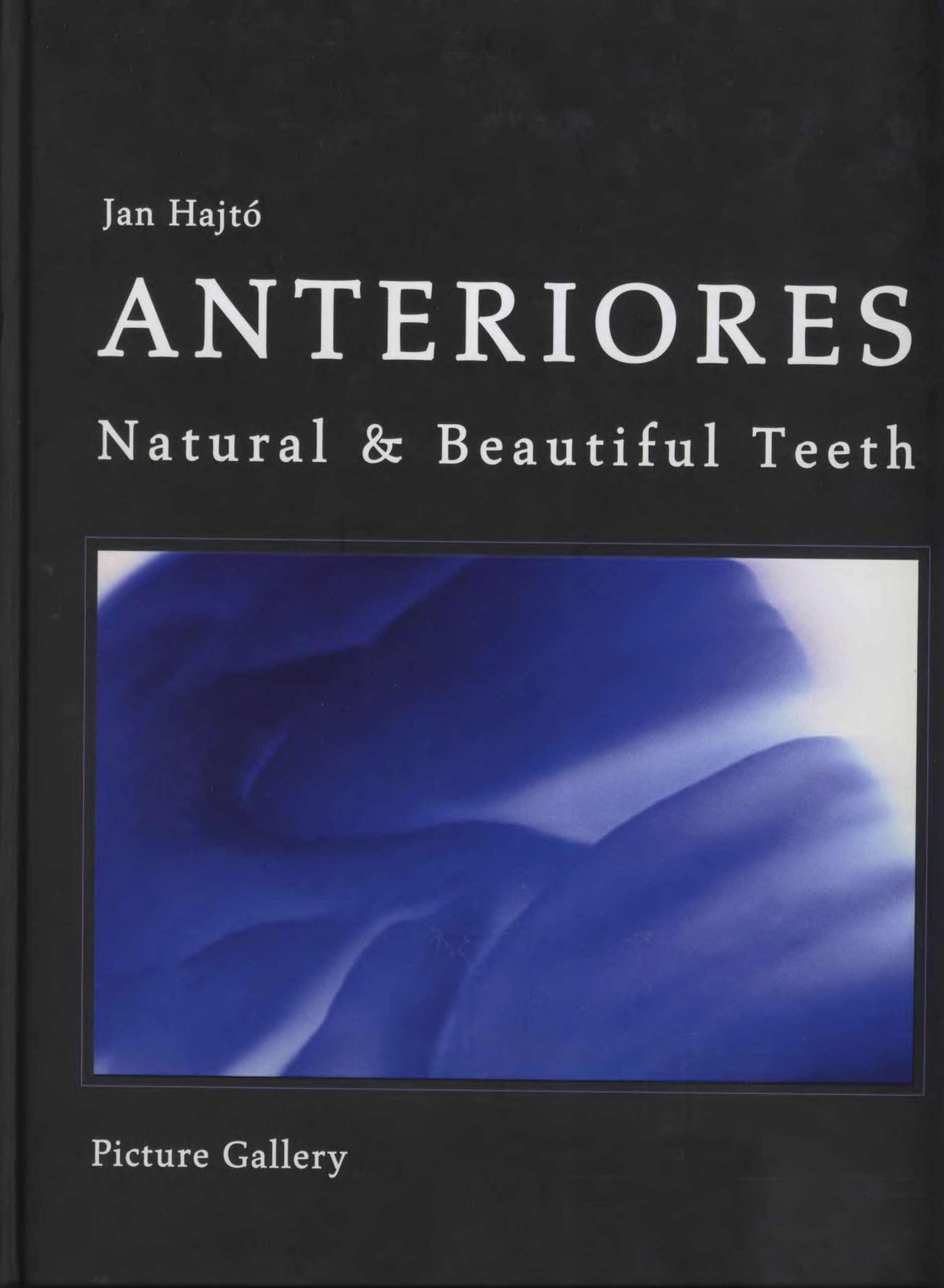 Anteriores-natural-beautiful-teeth-Jan-Hajto