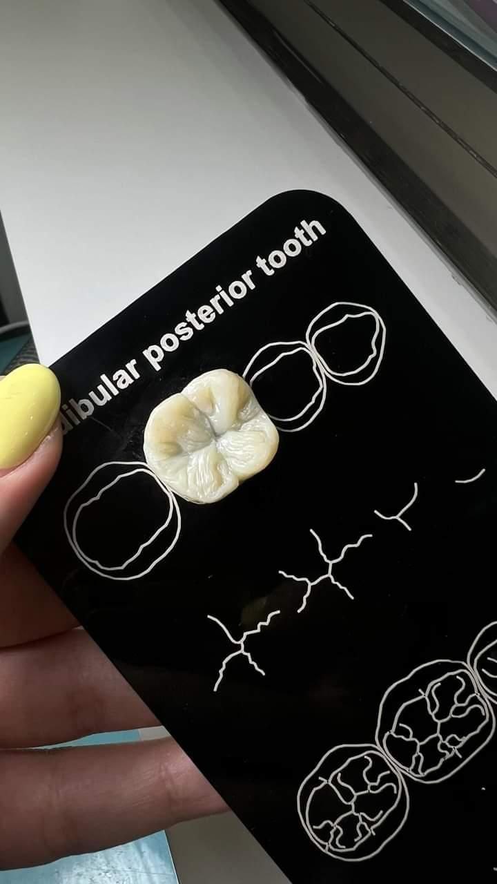 تمپلیت دندان های خلفی تمپلیت دندان های خلفی